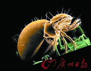 恙蟲為何總愛咬下體？